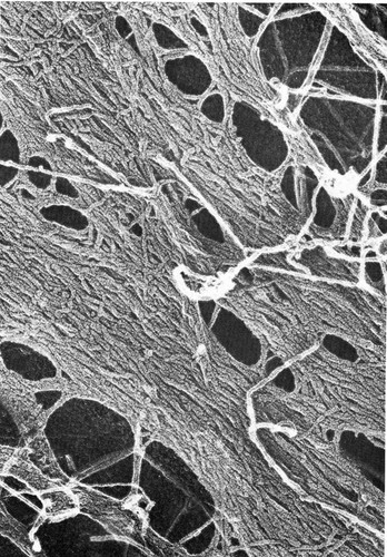 CIL:36071, Mus musculus, fibroblast