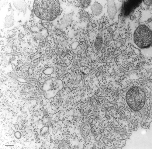 CIL:36235, Tetrahymena pyriformis, cell by organism, eukaryotic cell, Eukaryotic Protist, Ciliated Protist