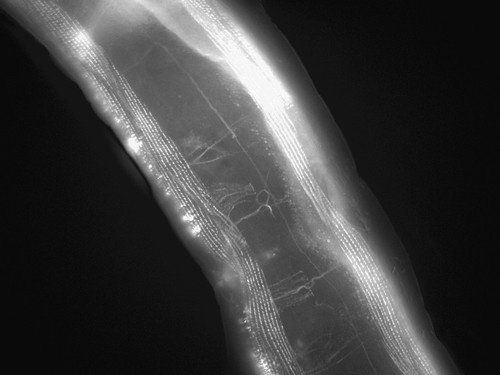 CIL:1153, Caenorhabditis elegans, muscle cell