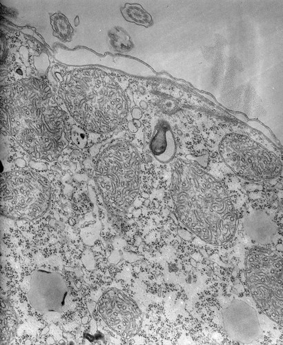 CIL:39722, Tetrahymena pyriformis, cell by organism, eukaryotic cell, Eukaryotic Protist, Ciliated Protist