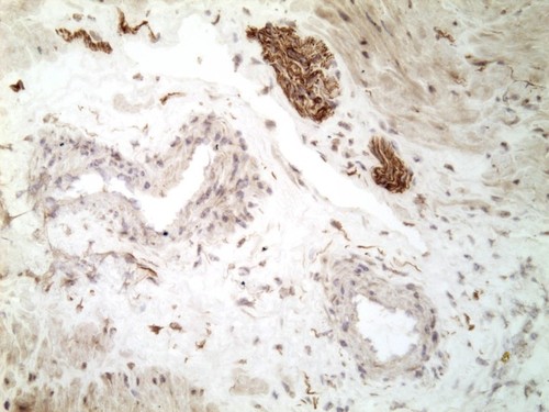 CIL:32671, Homo sapiens, endocrine-paracrine cell of prostate gland, basal cell of prostate epithelium, luminal cell of prostate epithelium, blood vessel endothelial cell, perineural cell, sheath cell, leukocyte, prostate stromal cell, smooth muscle cell of prostate