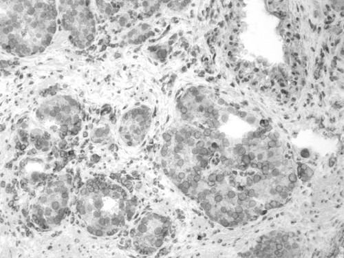 CIL:33682, Homo sapiens, endocrine-paracrine cell of prostate gland, basal cell of prostate epithelium, luminal cell of prostate epithelium, blood vessel endothelial cell, perineural cell, sheath cell, leukocyte, prostate stromal cell, smooth muscle cell of prostate