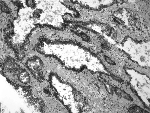 CIL:33660, Homo sapiens, endocrine-paracrine cell of prostate gland, basal cell of prostate epithelium, luminal cell of prostate epithelium, blood vessel endothelial cell, perineural cell, sheath cell, leukocyte, prostate stromal cell, smooth muscle cell of prostate