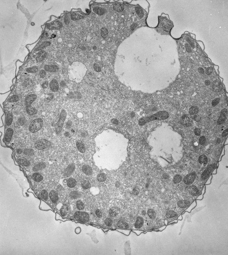 CIL:39792, Tetrahymena pyriformis, cell by organism, eukaryotic cell, Eukaryotic Protist, Ciliated Protist