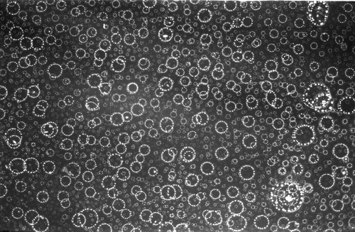 CIL:41553, Mus musculus, lymphocytic leukemia