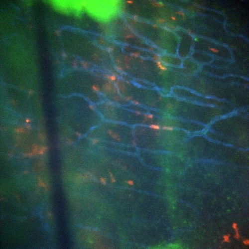 CIL:47299, Staphylococcus aureus, neutrophil, endothelial cell