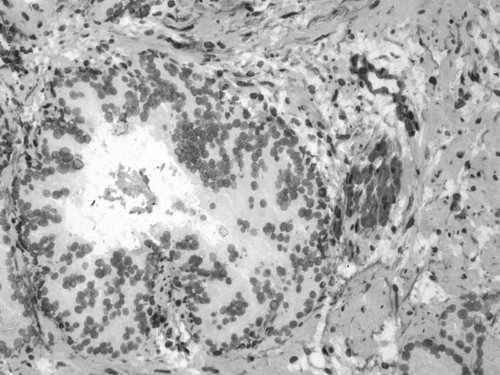 CIL:34110, Homo sapiens, endocrine-paracrine cell of prostate gland, basal cell of prostate epithelium, luminal cell of prostate epithelium, blood vessel endothelial cell, perineural cell, sheath cell, leukocyte, prostate stromal cell, smooth muscle cell of prostate