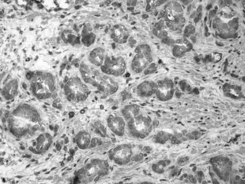 CIL:33676, Homo sapiens, endocrine-paracrine cell of prostate gland, basal cell of prostate epithelium, luminal cell of prostate epithelium, blood vessel endothelial cell, perineural cell, sheath cell, leukocyte, prostate stromal cell, smooth muscle cell of prostate