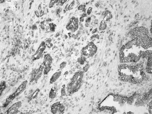 CIL:34225, Homo sapiens, endocrine-paracrine cell of prostate gland, basal cell of prostate epithelium, luminal cell of prostate epithelium, blood vessel endothelial cell, perineural cell, sheath cell, leukocyte, prostate stromal cell, smooth muscle cell of prostate