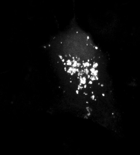 CIL:13914, Homo sapiens, permanent cell line cell