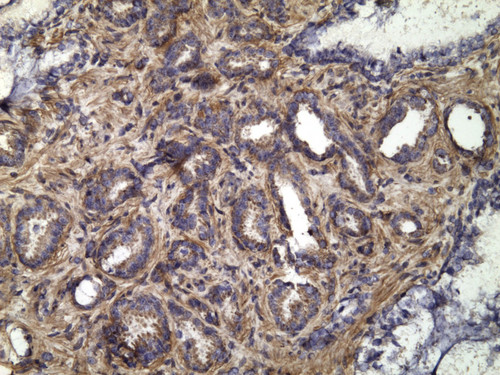 CIL:33348, Homo sapiens, endocrine-paracrine cell of prostate gland, basal cell of prostate epithelium, luminal cell of prostate epithelium, blood vessel endothelial cell, perineural cell, sheath cell, leukocyte, prostate stromal cell, smooth muscle cell of prostate