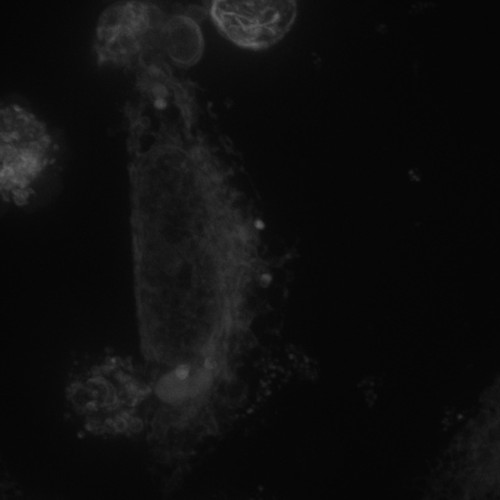 CIL:10017, Homo sapiens, permanent cell line cell, epithelial cell