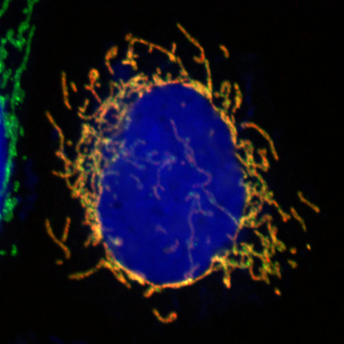 CIL: 53631, Homo sapiens, HeLa