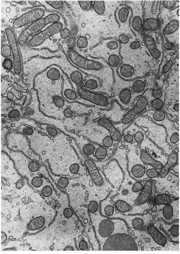 CIL:11399, Spermophilus citellus, epithelial cell