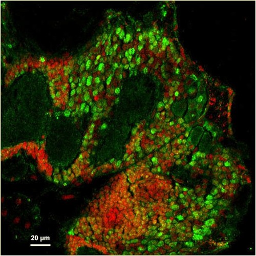 CIL:25381, Maize mosaic virus, Peregrinus maidis, CNS neuron (sensu Nematoda and Protostomia)