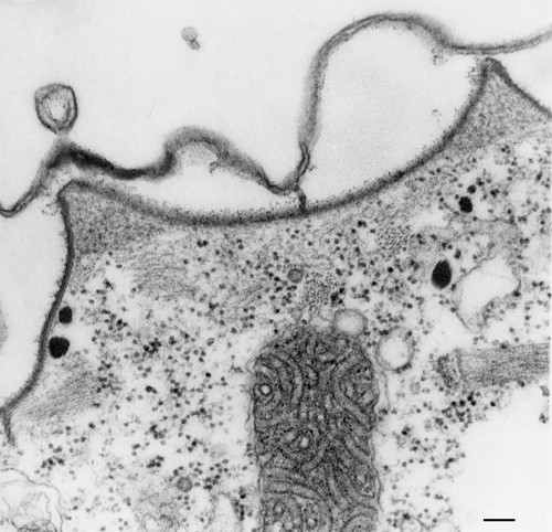 CIL:36601, Paramecium multimicronucleatum, cell by organism, eukaryotic cell, Eukaryotic Protist, Ciliated Protist