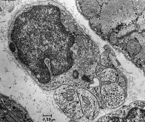 CIL:37217, Rattus, non-myelinating Schwann cell, nerve fibers
