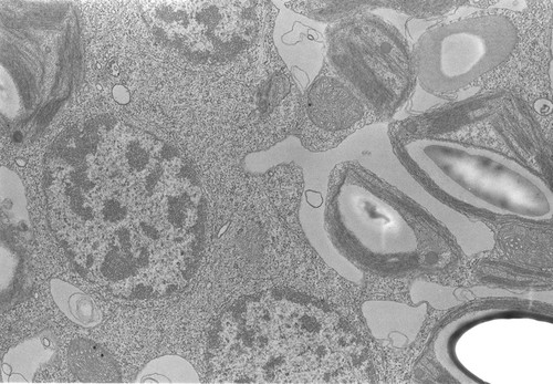 CIL:562, Acetabularia mediterranea, gamete