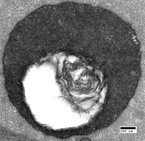 CIL:40447, Saccharomyces cerevisiae, vma9 mutant