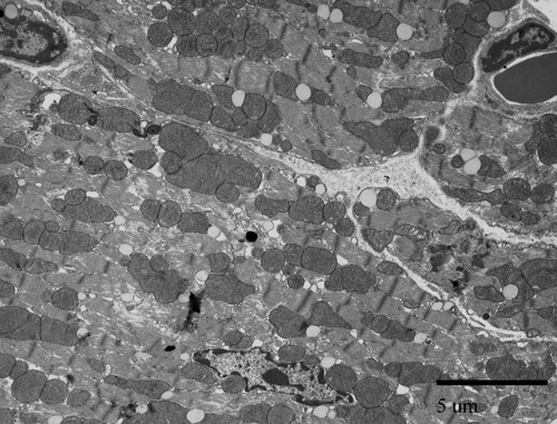 CIL:39775, Mus musculus, cardiac muscle cell