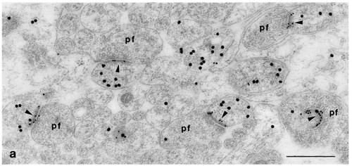 CIL:9153, Rattus, Purkinje cell