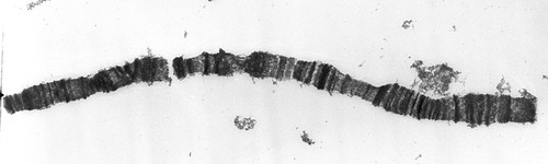 CIL:25511, Drosophila melanogaster, salivary gland