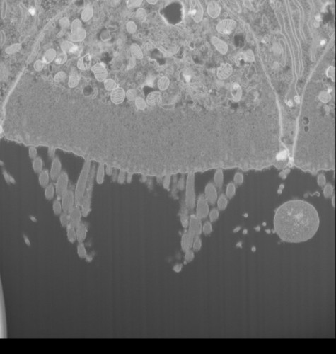 CIL: 50720, FIB-SEM Dataset of anti-PKHD1L1 Immuno-Gold Labeled Outer Hair Cell Stereocilia Bundles