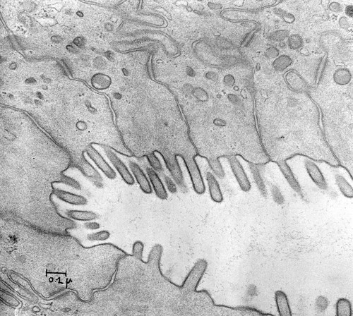 CIL:37161, Rattus rattus, epithelial cell