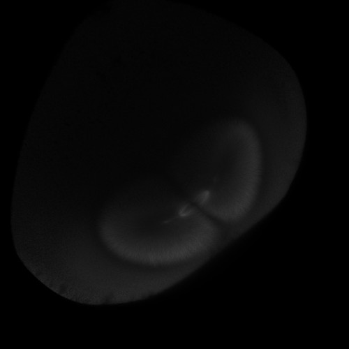 CIL:36587, Xenopus laevis, fertilized egg