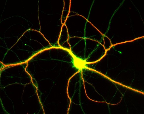 CIL:8728, Rattus, multipolar neuron