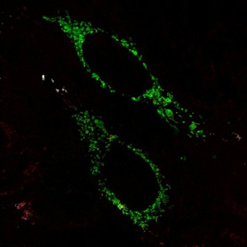 CIL:13730, Homo sapiens, endothelial cell