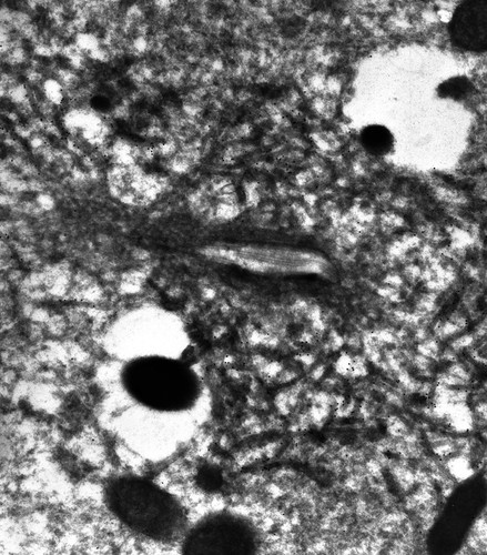 CIL:13121, Paramecium multimicronucleatum, cell by organism, eukaryotic cell, Eukaryotic Protist, Ciliated Protist