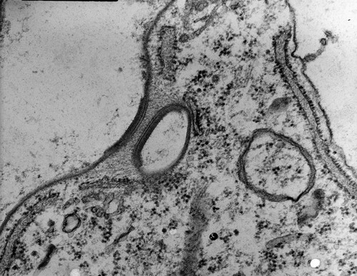 CIL:9254, Coleps hirtus, eukaryotic cell, Eukaryotic Protist, Ciliated Protist