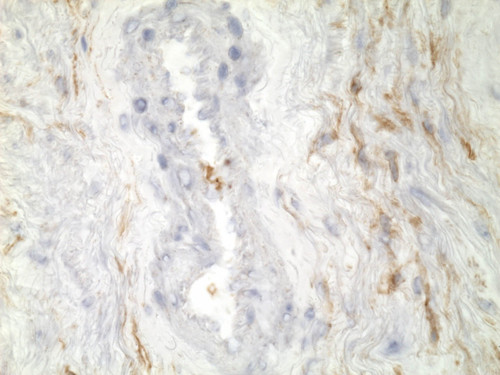 CIL:32928, Homo sapiens, endocrine-paracrine cell of prostate gland, basal cell of prostate epithelium, luminal cell of prostate epithelium, blood vessel endothelial cell, perineural cell, sheath cell, leukocyte, prostate stromal cell, smooth muscle cell of prostate