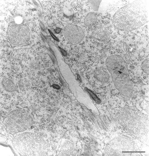 CIL:36228, Tetrahymena pyriformis, cell by organism, eukaryotic cell, Eukaryotic Protist, Ciliated Protist