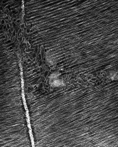 CIL:37367, damselfly, flight muscle cell