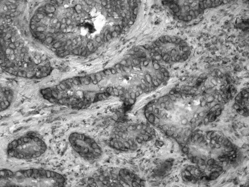 CIL:33666, Homo sapiens, endocrine-paracrine cell of prostate gland, basal cell of prostate epithelium, luminal cell of prostate epithelium, blood vessel endothelial cell, perineural cell, sheath cell, leukocyte, prostate stromal cell, smooth muscle cell of prostate