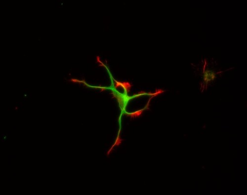 CIL:8781, Rattus, multipolar neuron