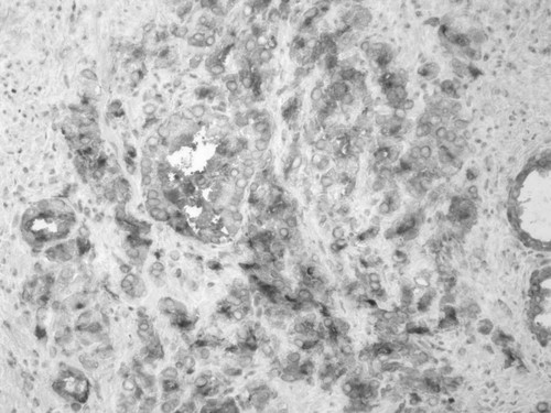 CIL:32186, Homo sapiens, endocrine-paracrine cell of prostate gland, basal cell of prostate epithelium, luminal cell of prostate epithelium, blood vessel endothelial cell, perineural cell, sheath cell, leukocyte, prostate stromal cell, smooth muscle cell of prostate