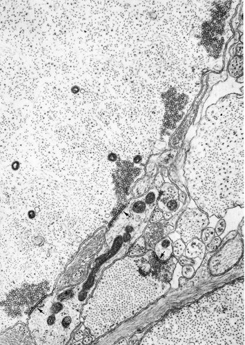 CIL:36013, Petromyzon marinus, Mueller cell