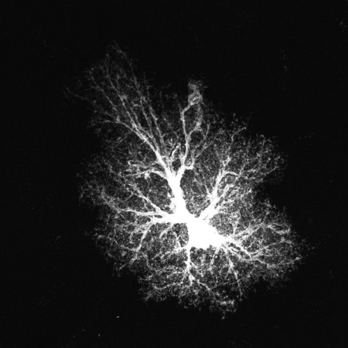 CIL:36366, Rattus norvegicus, astrocyte, astrocyte of the hippocampus