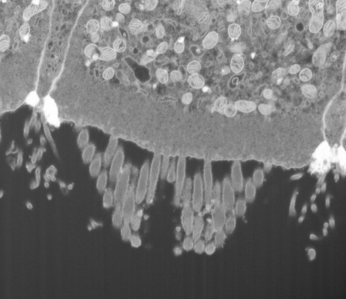 CIL: 50688, FIB-SEM Dataset of anti-PKHD1L1 Immuno-Gold Labeled Outer Hair Cell Stereocilia Bundles