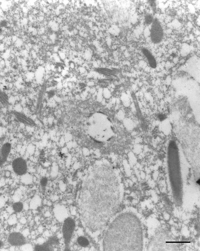 CIL:9853, Paramecium tetraurelia, cell by organism, eukaryotic cell, Eukaryotic Protist, Ciliated Protist