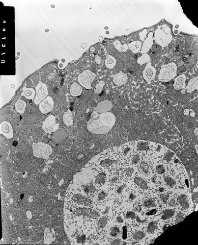 CIL:38831, Colpoda cucullus, cell by organism, eukaryotic cell, Eukaryotic Protist, Ciliated Protist