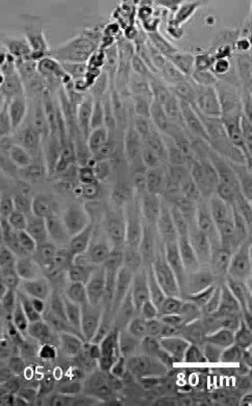 CIL:46351, Mus musculus, mammary adenocarcinoma