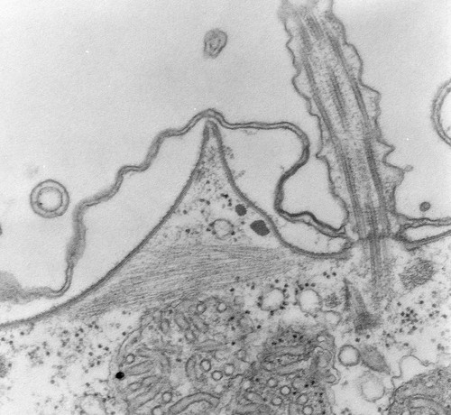 CIL:39308, Paramecium multimicronucleatum, cell by organism, eukaryotic cell, Eukaryotic Protist, Ciliated Protist