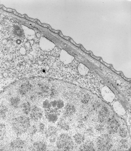 CIL:39461, Vorticella convallaria, cell by organism, eukaryotic cell, Eukaryotic Protist, Ciliated Protist