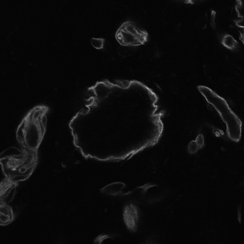 CIL:12292, Mus musculus, epithelial cell