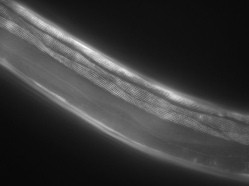 CIL:1046, Caenorhabditis elegans, muscle cell