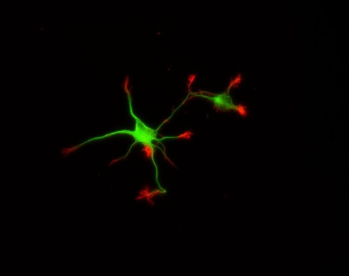 CIL:8783, Rattus, multipolar neuron